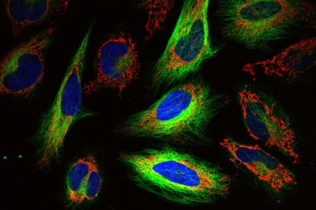multicolor_fluorescence_image_of_living_hela_cells